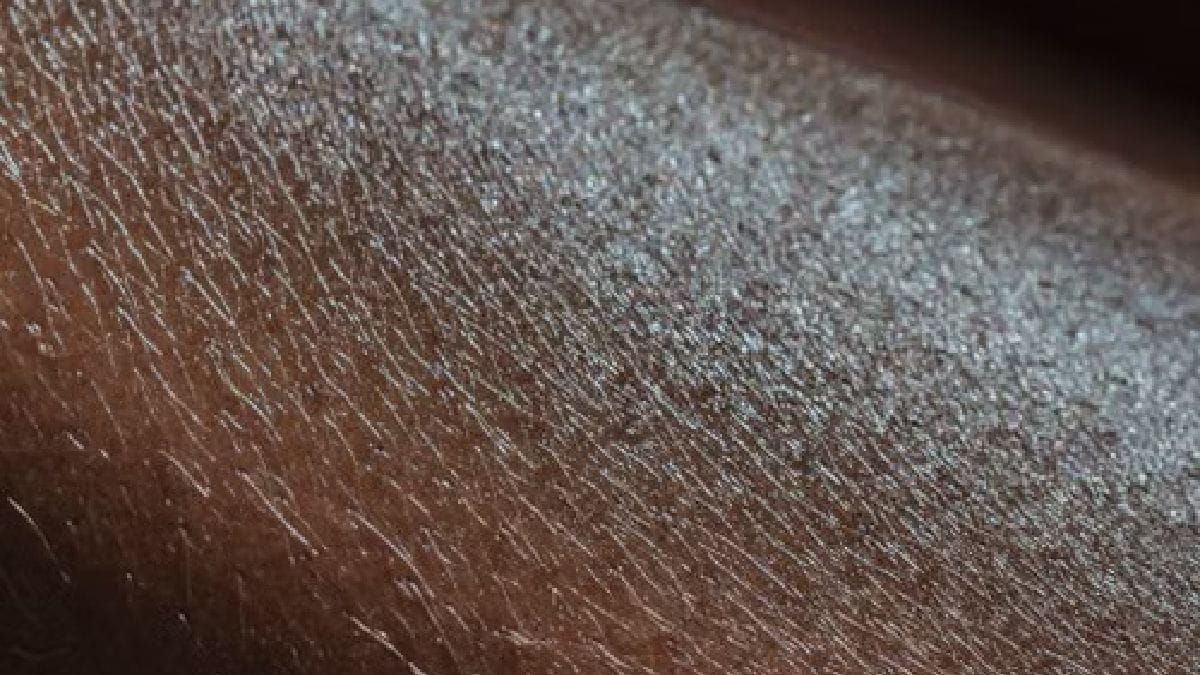 A penugem é formada por pelos curtos e finos que cobrem grande parte da pele humana (Foto: Angela Roma / Pexels)