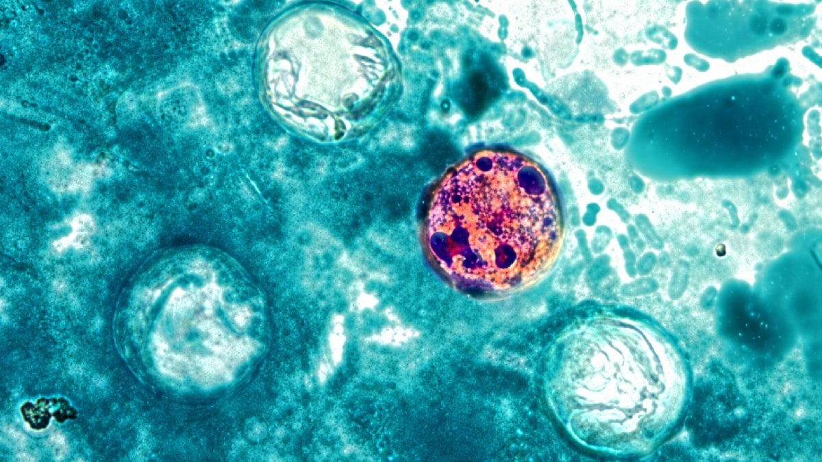 Além disso, os testes comuns de fezes nem sempre procuram especificamente a Cyclospora. Em certos casos, o médico precisa solicitar uma análise direcionada (Foto: CDC / Wikimedia Commons / Imagem Tratada)