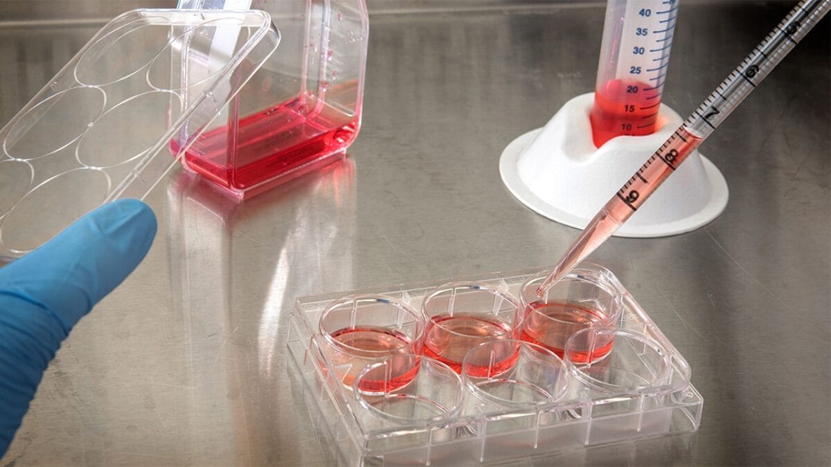 Pesquisadores da Universidade de São Paulo (USP) desenvolvem estudo experimental com células da mucosa olfativa para tratamento de lesão medular. A pesquisa está em fase preliminar em ratos.
