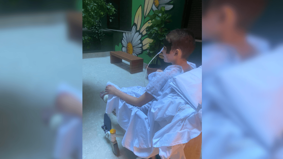 Jovem de Xanxerê queimada
