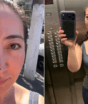 Após quase perder parte do nariz, Juliane Massaoka, do Mais Você, adota curativo divertido em meio a tratamento