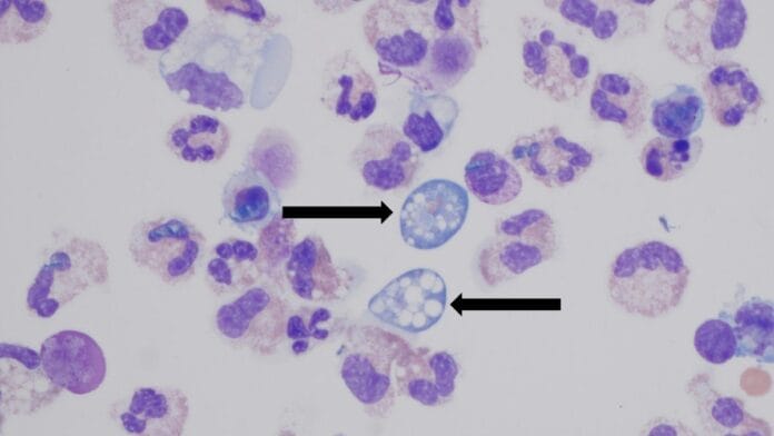 Amostra microscópica com células e setas pretas apontando para a ameba comedora de cérebro (Naegleria fowleri).