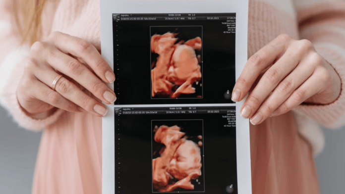 Mesmo quando dois embriões têm origens genéticas diferentes, eles podem seguir seu desenvolvimento durante a mesma gestação (Foto: Pavel Danilyuk / Pexels)