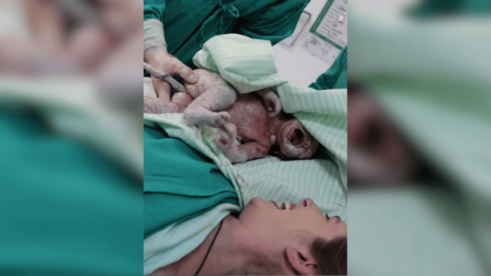 "Emoção indescritível": Médico faz parto da própria filha e relata misto de medo e alívio em SC