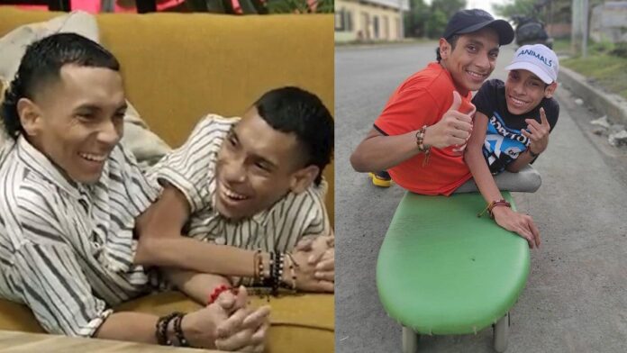 Gêmeos siameses morrem aos 27 anos após viajarem para realizar sonho que tinham desde a infância