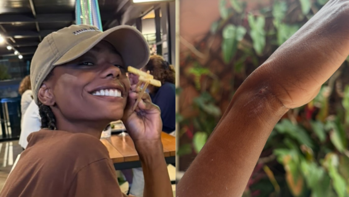 Após ficar 3 dias desaparecida, modelo Dandara Couto reaparece nas redes sociais e mostra marcas pelo corpo