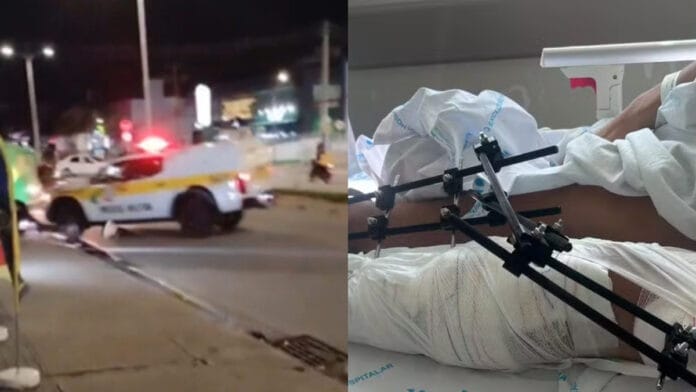 Motociclista atropelado por viatura da PM é solto e Justiça manda investigar policiais envolvidos em Florianópolis