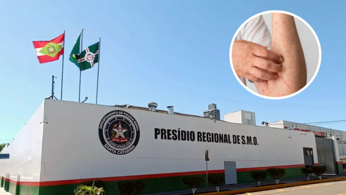 Suspeitas de casos de catapora ocorrem no Presídio Regional de São Miguel do Oeste (Foto: Sejuri, Divulgação)